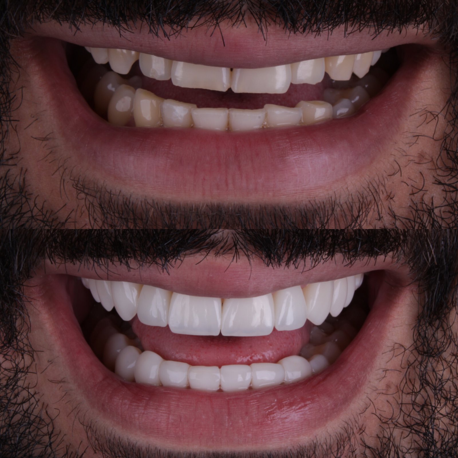 InShot_20231226_204815431