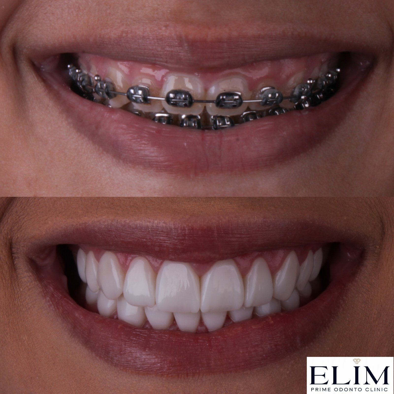 MEITU_20241216_185807906 (1)