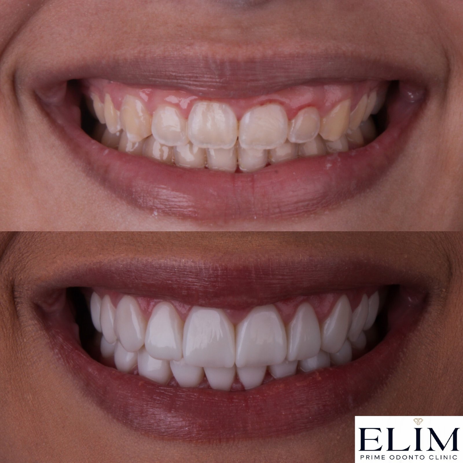 MEITU_20241216_191155072