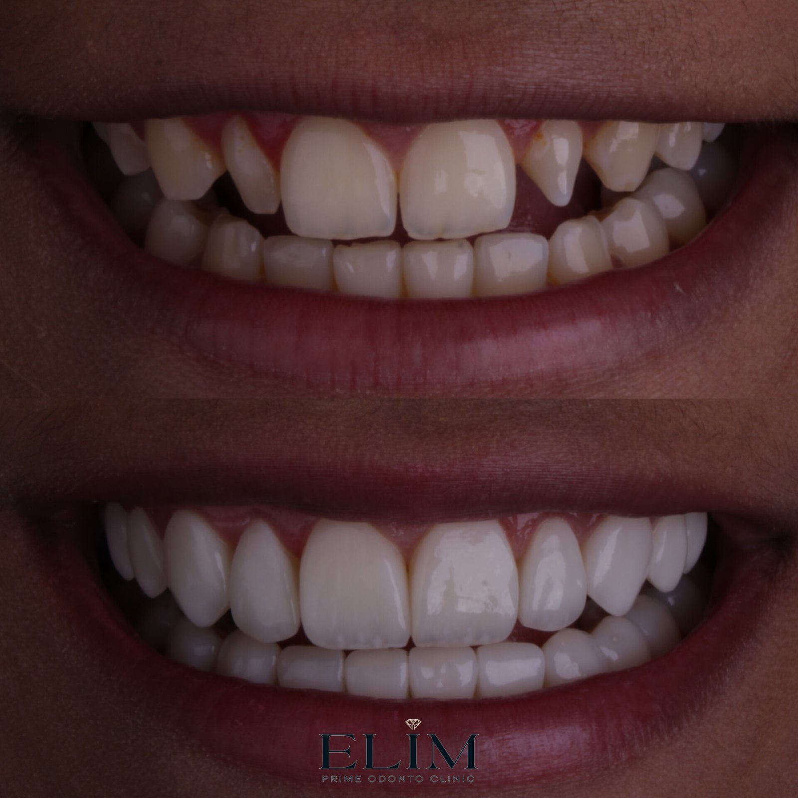 MEITU_20250714_105415126