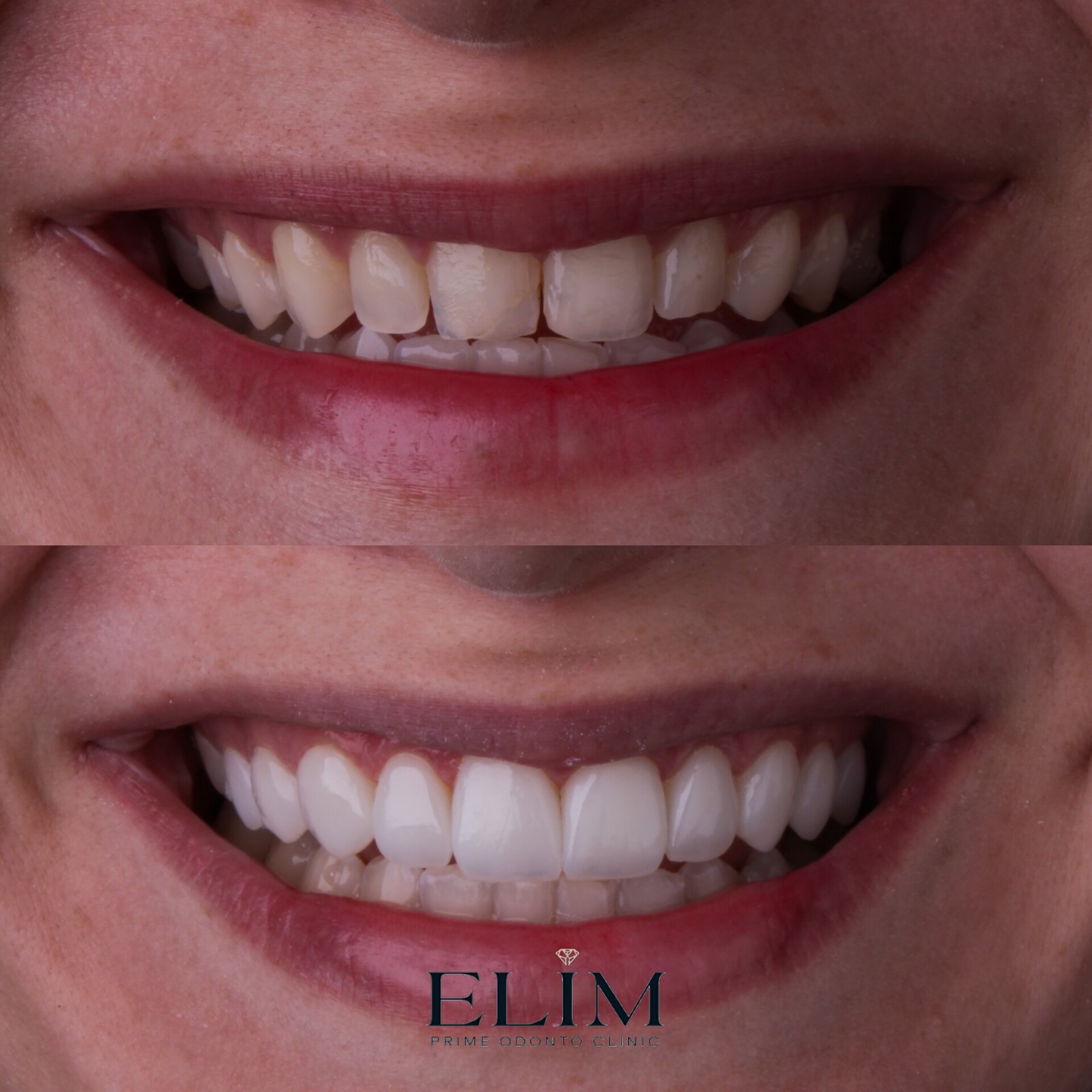 MEITU_20251108_105535810